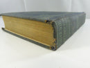 Loose endpapers with exposed binding material