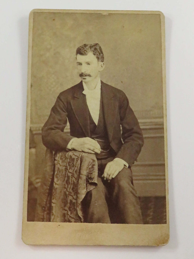 Antique CDV 21 Years of Age Man with Unusual Hands Early Card 4 1/8" x 2 1/2"